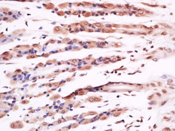 Ubiquitously expressed transcript Rabbit Polyclonal Antibody