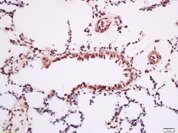 Ubiquitously expressed transcript Rabbit Polyclonal Antibody