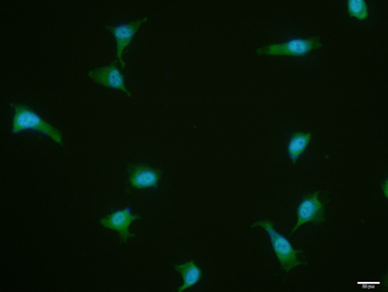 PKM2 Mouse Polyclonal Antibody