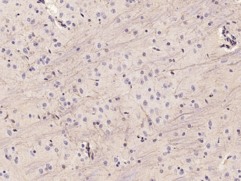 KCNMA1/BK channel Rabbit Polyclonal Antibody