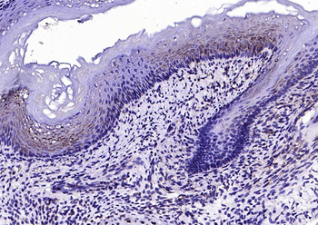 BMPR1A Rabbit Polyclonal Antibody