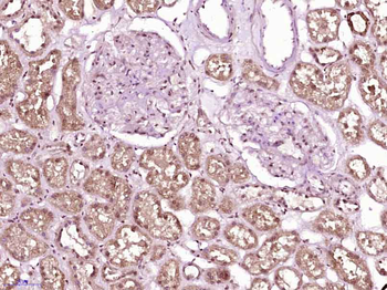 SMARCA4 Rabbit Polyclonal Antibody