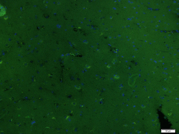 PAK3 Rabbit Polyclonal Antibody