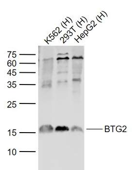 BTG2 Rabbit Polyclonal Antibody