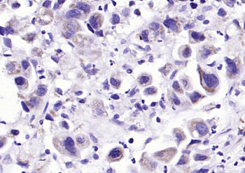 CAPN1 Rabbit Polyclonal Antibody