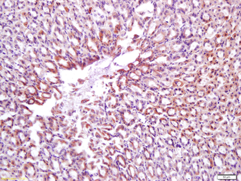 CNN1 Rabbit Polyclonal Antibody