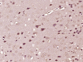 NDRG1 Rabbit Polyclonal Antibody