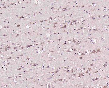 CASPR Rabbit Polyclonal Antibody