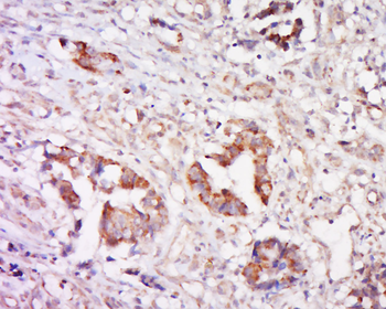 Cathepsin L Rabbit Polyclonal Antibody