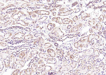 Cathepsin H Rabbit Polyclonal Antibody