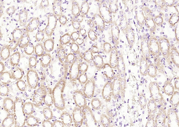 Cathepsin H Rabbit Polyclonal Antibody
