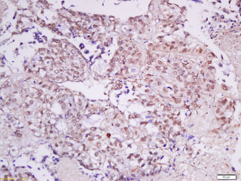 KAT3A / CBP Rabbit Polyclonal Antibody