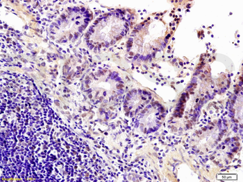 HP1 gamma Rabbit Polyclonal Antibody