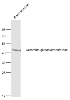 Ceramide glucosyltransferase Rabbit Polyclonal Antibody