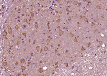 CCK8 Rabbit Polyclonal Antibody