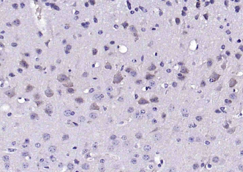 VAT1L Rabbit Polyclonal Antibody