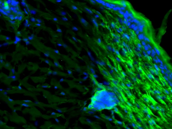 CXCL10/IP10 Rabbit Polyclonal Antibody