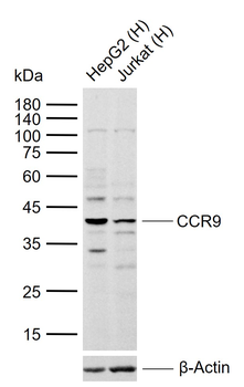 CCR9 Rabbit Polyclonal Antibody