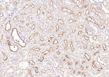 CD10 Rabbit Polyclonal Antibody