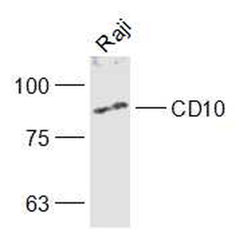 CD10 Rabbit Polyclonal Antibody