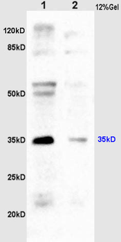 CD24 Rabbit Polyclonal Antibody