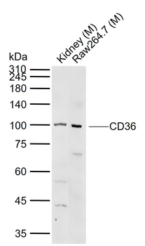 CD36 Rabbit Polyclonal Antibody