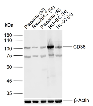 CD36 Rabbit Polyclonal Antibody