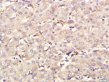 CD40L Rabbit Polyclonal Antibody