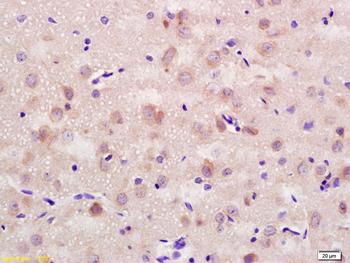 CD56 Rabbit Polyclonal Antibody