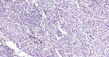 E-Selectin Rabbit Polyclonal Antibody