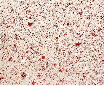 CD68 Rabbit Polyclonal Antibody
