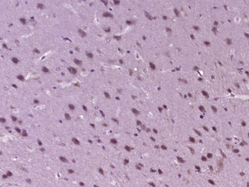 CDC34 Rabbit Polyclonal Antibody
