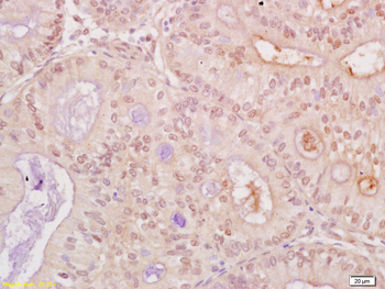 CDK1 Rabbit Polyclonal Antibody