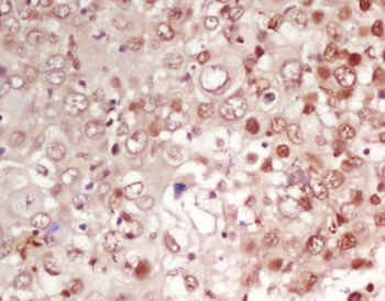 CDK1 Rabbit Polyclonal Antibody