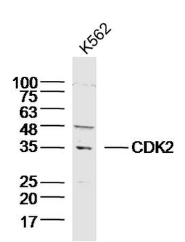 CDK2 Rabbit Polyclonal Antibody