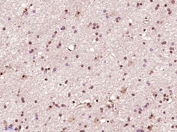 CDK6 Rabbit Polyclonal Antibody