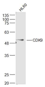 CDK9 Rabbit Polyclonal Antibody