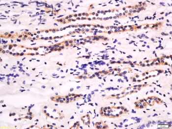 CDK9 Rabbit Polyclonal Antibody