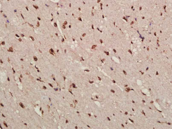 Cdkn1c Rabbit Polyclonal Antibody