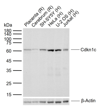 Cdkn1c Rabbit Polyclonal Antibody