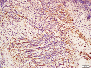 CHI3L1 Rabbit Polyclonal Antibody