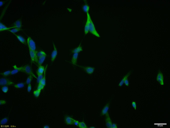 CHI3L1 Rabbit Polyclonal Antibody
