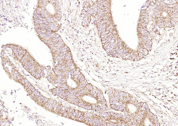 CEAcam8 Rabbit Polyclonal Antibody