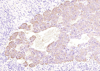 Chromogranin B Rabbit Polyclonal Antibody