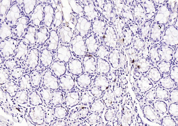 Chromogranin B Rabbit Polyclonal Antibody