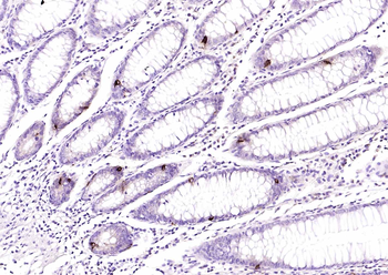 Chromogranin B Rabbit Polyclonal Antibody