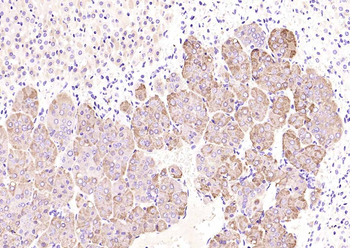 Chromogranin B Rabbit Polyclonal Antibody