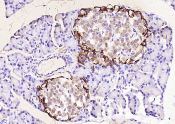 Chromogranin B Rabbit Polyclonal Antibody