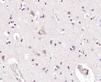 SET Rabbit Polyclonal Antibody