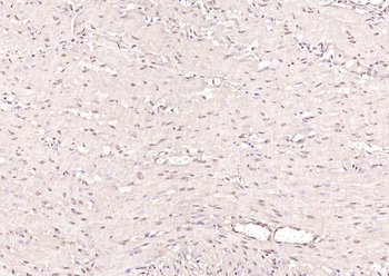 Proteasome 20S alpha 1 Rabbit Polyclonal Antibody